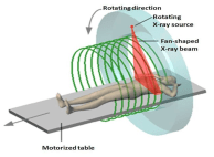 CT scan technique.png